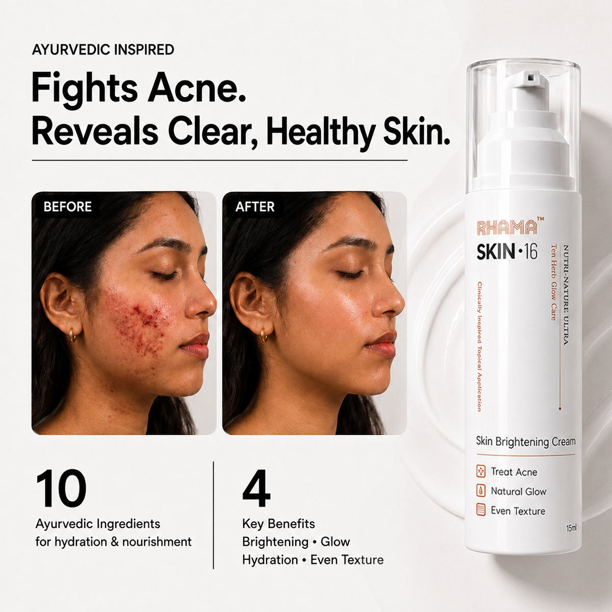 RHAMA Skin.16 Cream | Helps Dark Spots, Acne Marks & Pigmentation Removal | Glass Skin Glow | 15ml