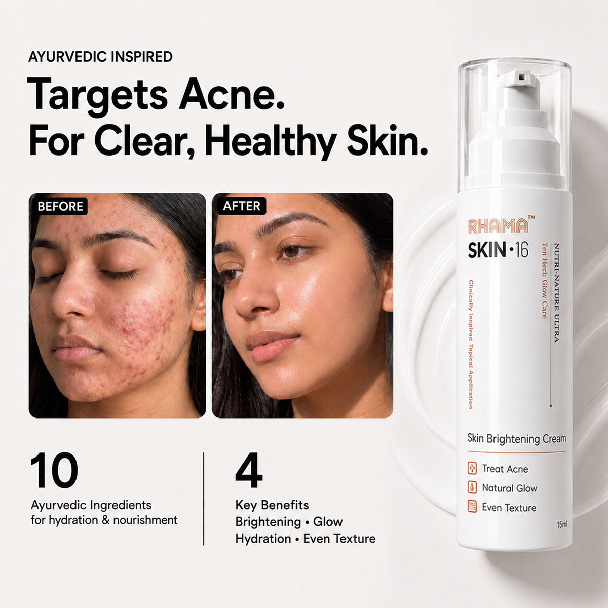 RHAMA Skin.16 Cream | Helps Dark Spots, Acne Marks & Pigmentation Removal | Glass Skin Glow | 15ml