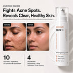 RHAMA Skin.16 Cream | Helps Dark Spots, Acne Marks & Pigmentation Removal | Glass Skin Glow | 15ml