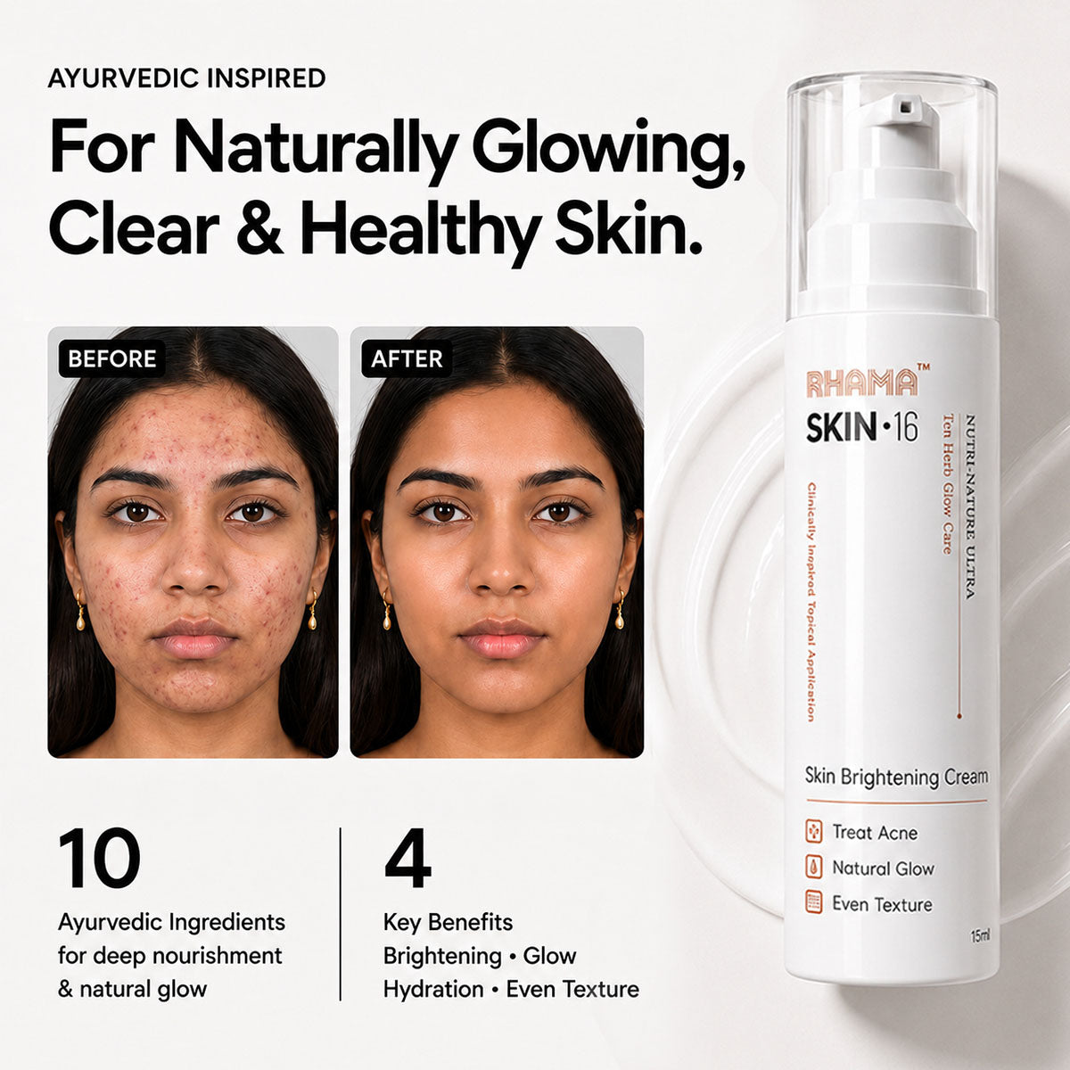 RHAMA Skin.16 Cream | Helps Dark Spots, Acne Marks & Pigmentation Removal | Glass Skin Glow | 15ml
