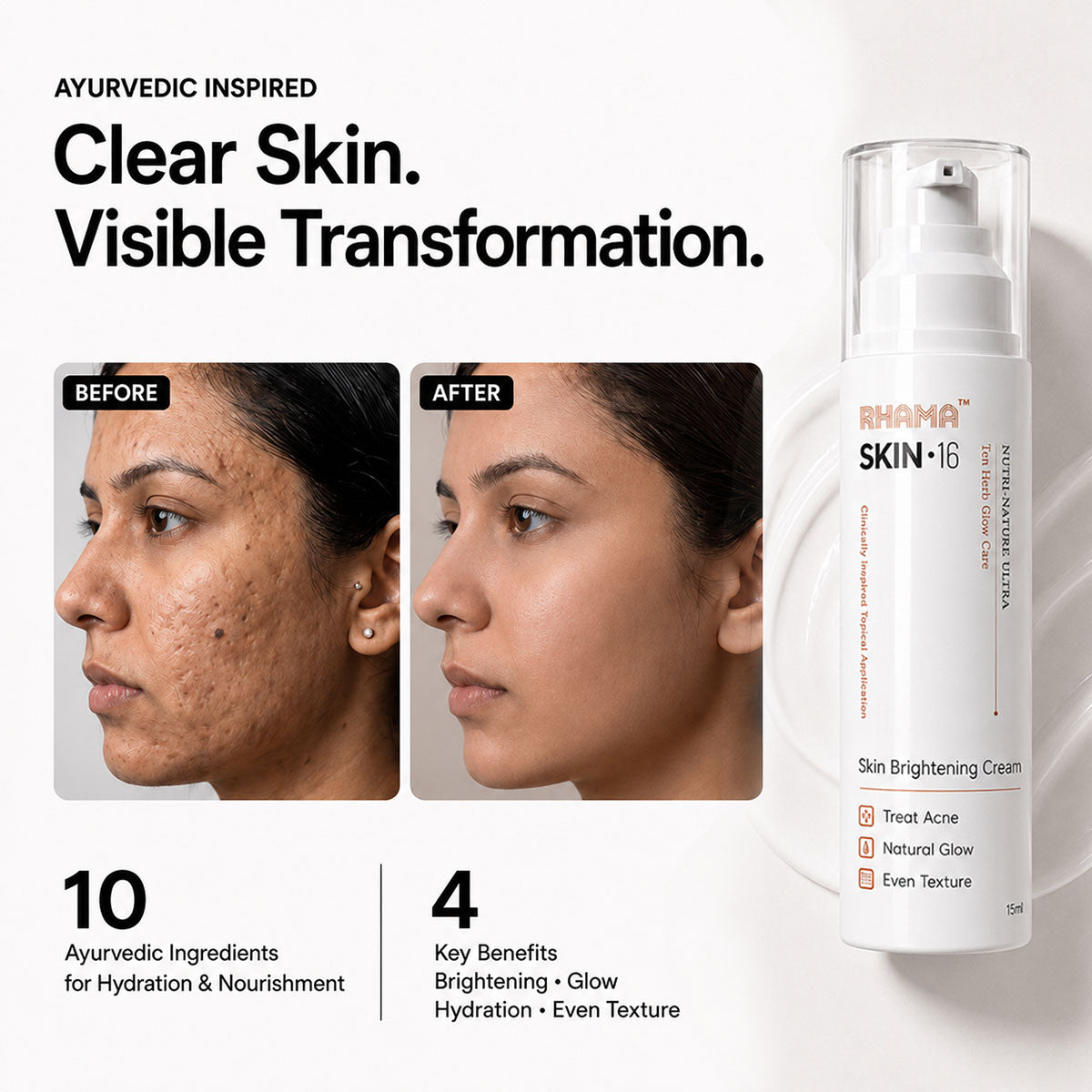 RHAMA Skin.16 Cream | Helps Dark Spots, Acne Marks & Pigmentation Removal | Glass Skin Glow | 15ml